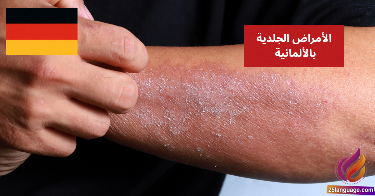Meine Haut juckt أسماء الأمراض الجلدية بالألمانية